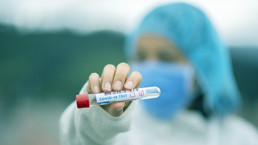 Pandemija ne jenjava, broj novozaraženih u Bjelovarsko-bilogorskoj županiji opet je velik