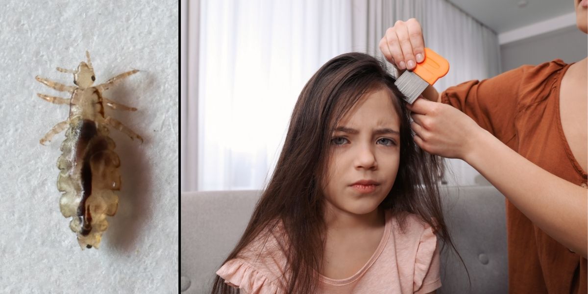 Neugodna istina o ušima: Ovi dosadni paraziti kriju puno toga, pa i razlog češkanja glave